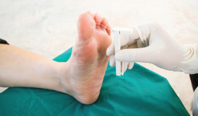 Prevent Foot and Leg Ulcers