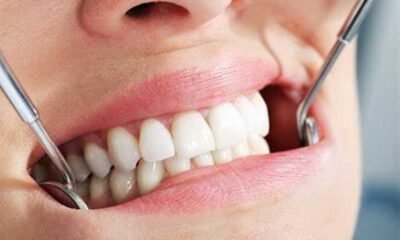 How To Choose A Dental Implant Center For You